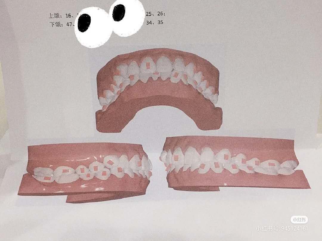 我的动图方案 我的动图方案